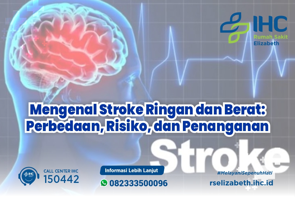 Mengenal Stroke Ringan dan Berat: Perbedaan, Risiko, dan Penanganan