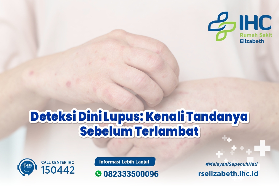 Deteksi Dini Lupus: Kenali Tandanya Sebelum Terlambat